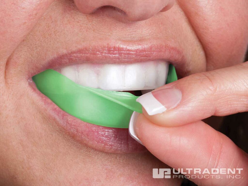 ultradent mouthguard