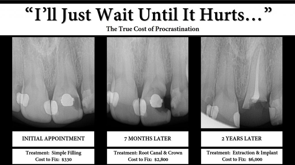 The Proactive vs. Reactive Dentist